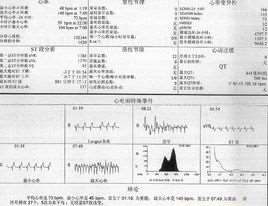 心律不齐是怎么回事