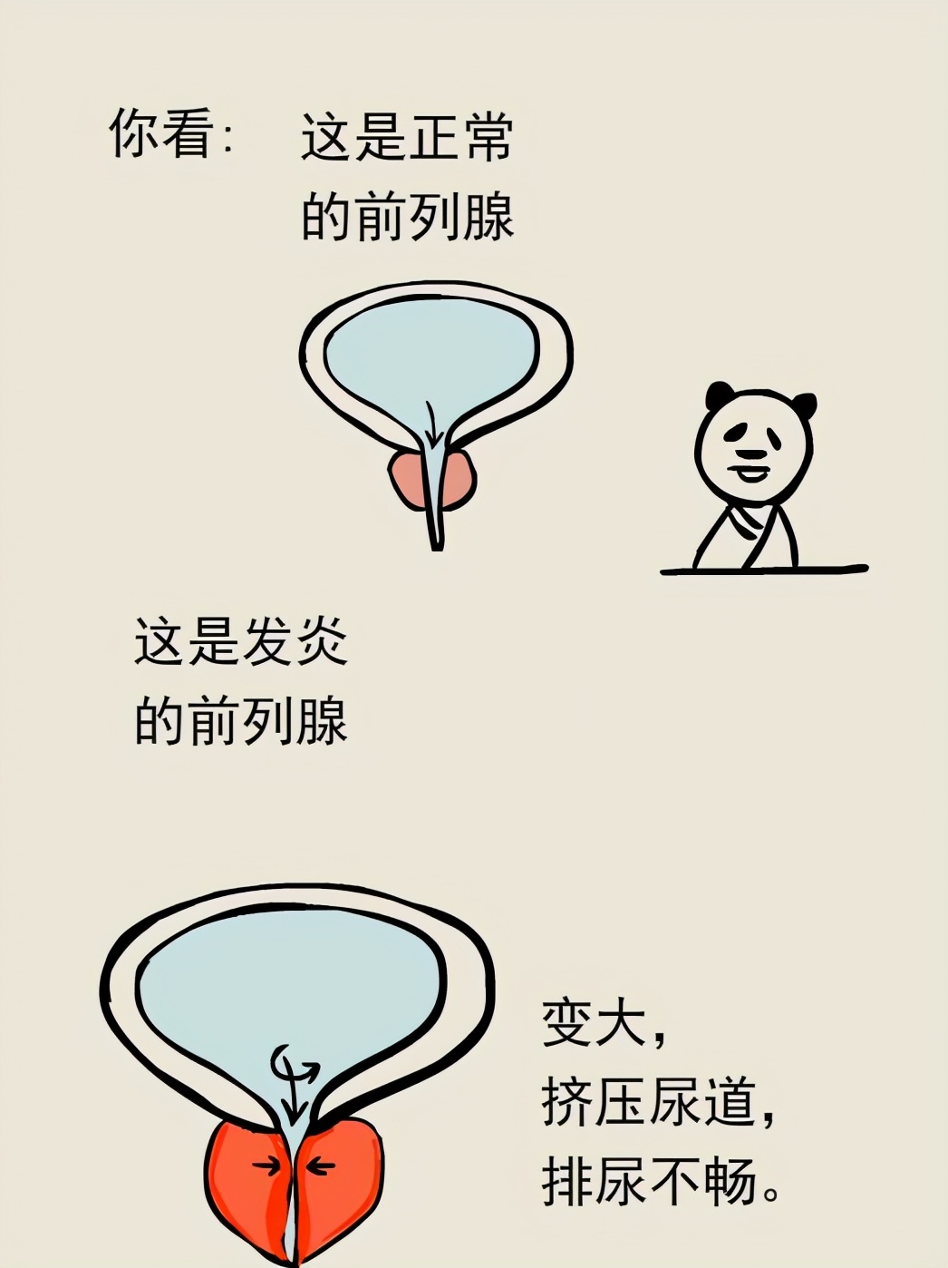 医生详细分析了这个前列腺炎案例，并提出治疗方案